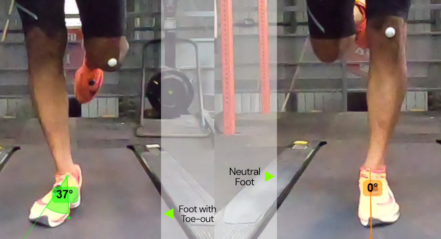Toe In Toe Out - Getting Your Correct Shoe Alignment 